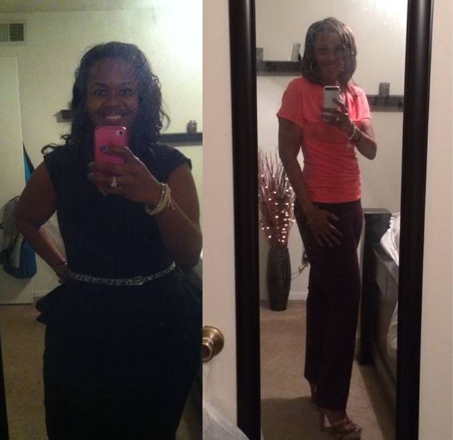 American Patient Praises Gastric Sleeve Surgery in Mexico After Losing